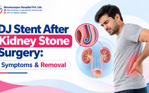 DJ Stent After Kidney Stone Surgery: Symptoms & Removal
